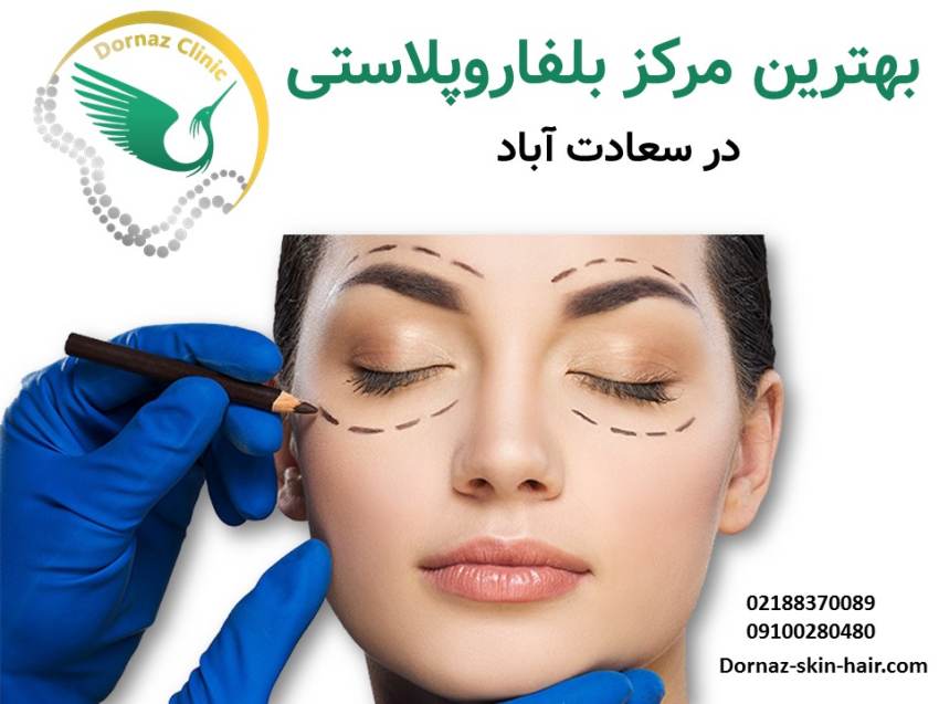 بهترین مرکز بلفاروپلاستی در سعادت آباد