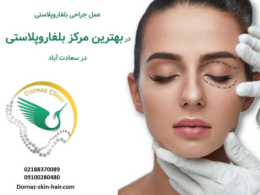 بهترین مرکز بلفاروپلاستی