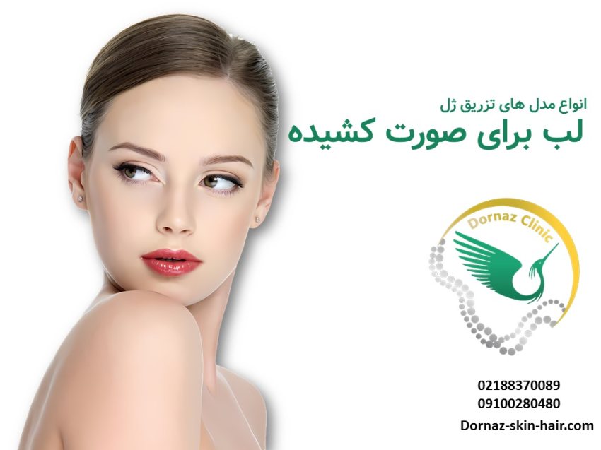 انواع مدل ژل لب برای صورت های کشیده