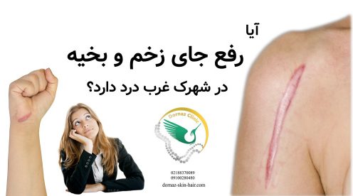 آیا رفع جای زخم و بخیه در شهرک غرب درد دارد؟