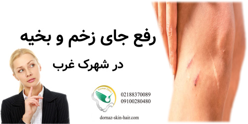 رفع جای زخم و بخیه شهرک غرب