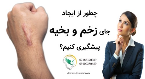 چطور از ایجاد جای زخم و بخیه پیشگیری کنیم؟