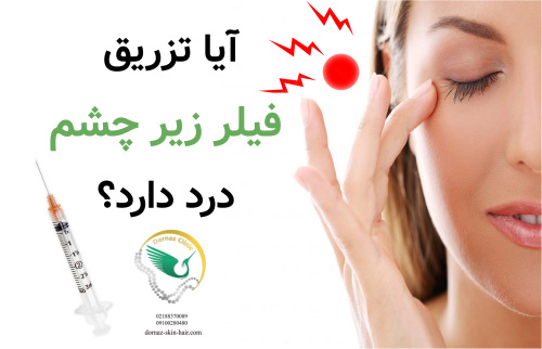 آیا تزریق فیلر زیر چشم درد دارد؟