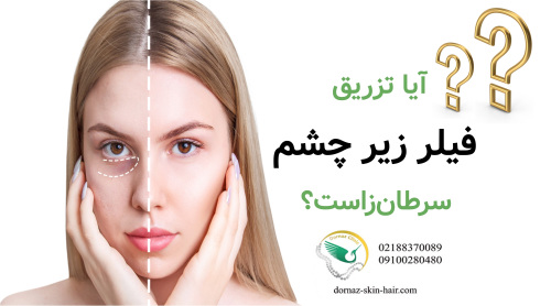 آیا تزریق فیلر زیر چشم سرطان‌زاست؟