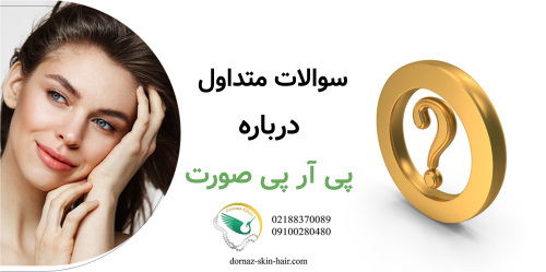 سوالات متداول در مورد پی ار پی صورت