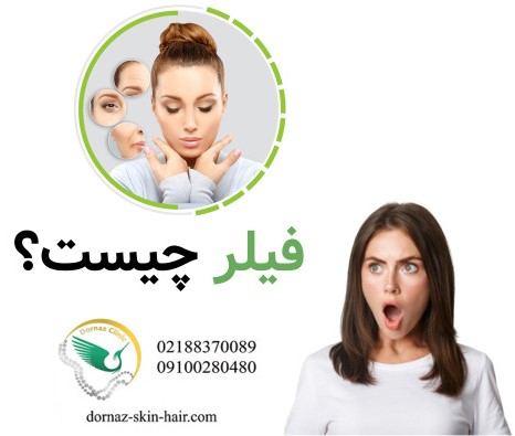 فیلر چیست؟