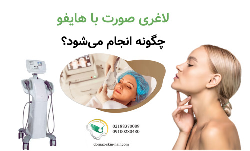 لاغری صورت با هایفو چگونه انجام می‌شود؟