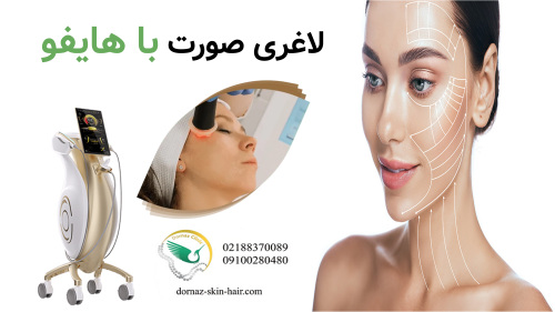 لاغری صورت با هایفو