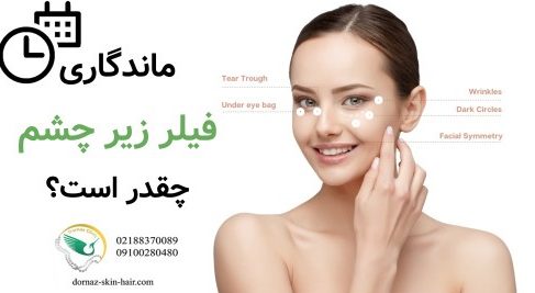 ماندگاری فیلر زیر چشم چقدر است
