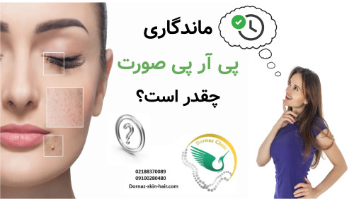 ماندگاری پی آر پی صورت چقدر است
