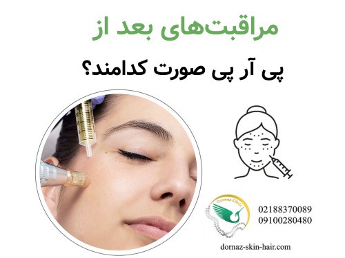 مراقبت‌های بعد از پی آر پی صورت کدامند؟