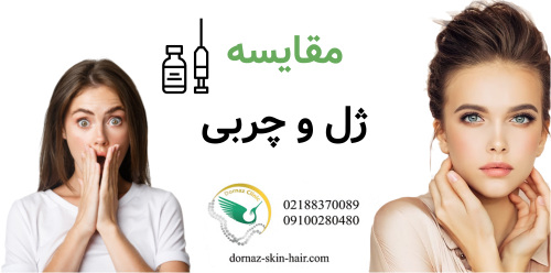 مقایسه ژل و چربی