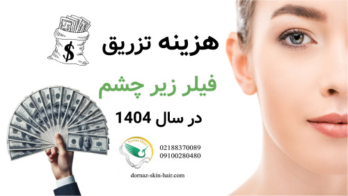 هزینه تزریق فیلر زیر چشم در سال 1404