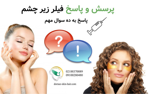 پرسش و پاسخ فیلر زیر چشم پاسخ به ده سوال مهم