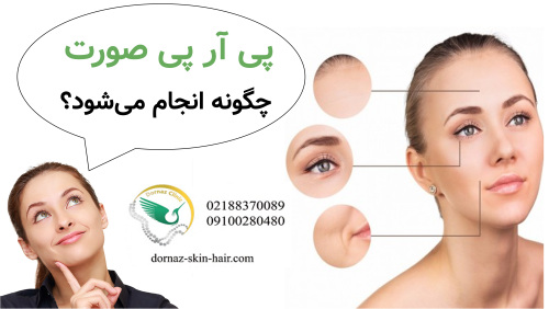پی آر پی صورت چگونه انجام می‌شود؟