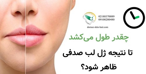 چقدر طول می‌کشد تا نتیجه ژل لب صدفی ظاهر شود؟