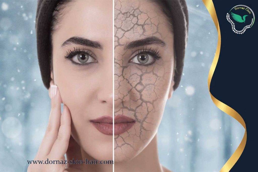 دلایل جلوگیری از پیری زودرس پوست