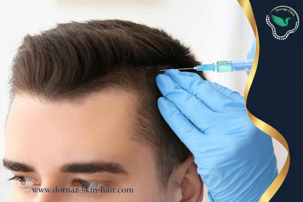 مراقبت های بعد از مزوتراپي