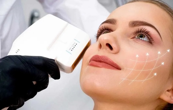 راهنمای هایفوتراپی صورت