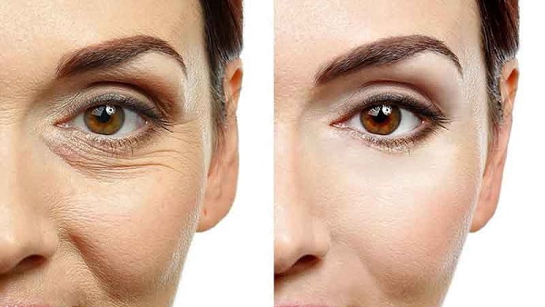 کاربرد و مزایای کربوکسی تراپی