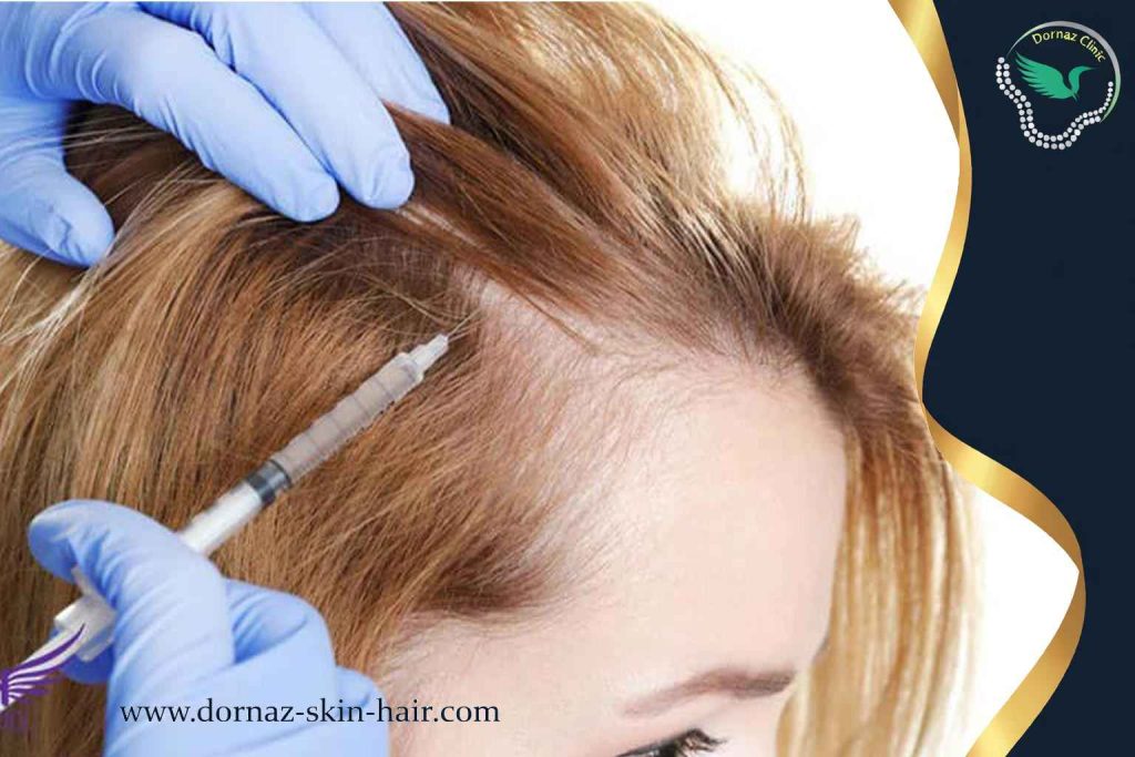 مزایا و محدودیت‌های پی آر پی مو